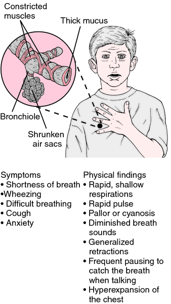 what triggers bronchial asthma