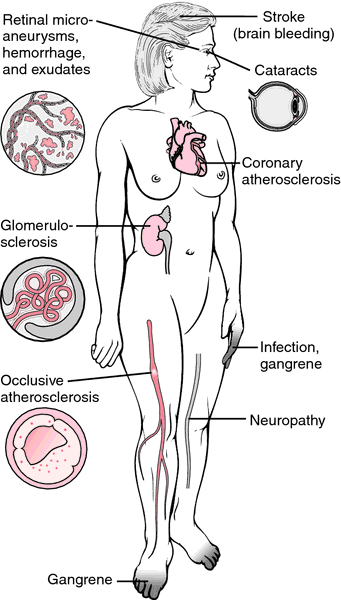 Diseases and Conditions - Information on.