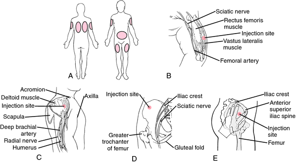 B, intramuscular injection