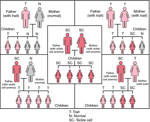 Sickle Cell Disease Definition Of Sickle Cell Disease By Medical Dictionary 8308