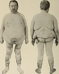 Nervous and mental diseases (1919) (14781727145).jpg
