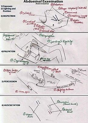 Abdominal examination illustration.jpg