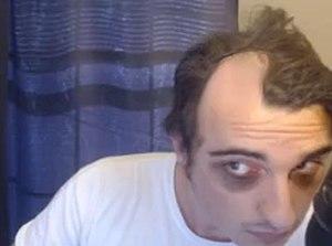 Man with racoon eyes.jpg