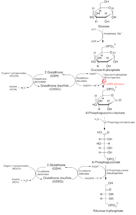 Pathology of G6PD deficiency.png