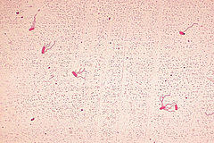 Alcaligenes faecalis PHIL-stained.jpg
