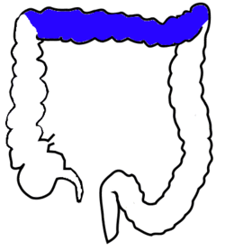 ColonTrasverso.png