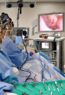 Mani Zadeh MD Endoscopic Sinus Surgery.jpg