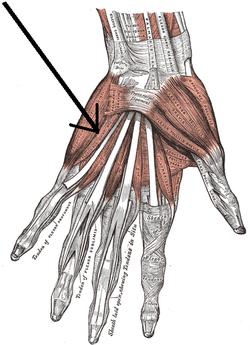 Musculusflexordigitiminimibrevismanus.png