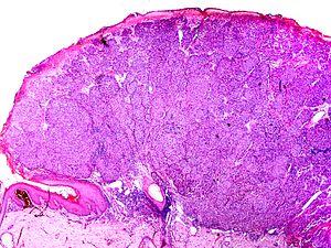 Skin Tumors-P6251257.jpg