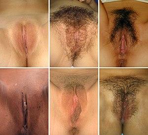 Genital Diversity Expanded.jpg