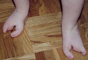 Deux pieds 1 an.jpg