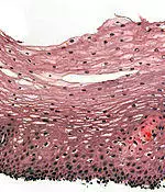 Histological section of the esophageal wall.