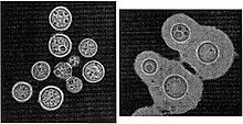 Cryptococcus gattii 02.jpg