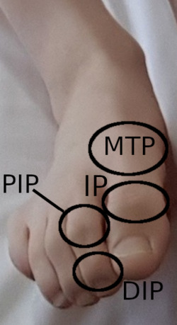 DIP, PIP, IP and MTP joints of the foot.png