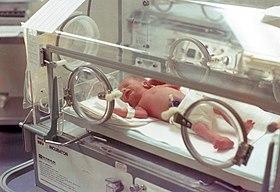 Infant-Incubator-wBaby-1978-USA.jpg