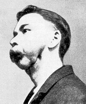 Match factory worker with phossy jaw.jpg