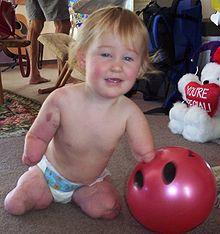 Charlotte Cleverley-Bisman.jpg