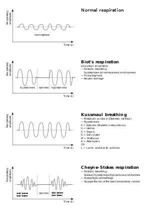 Breathing abnormalities.svg
