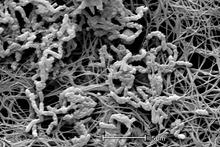 Achromobacter xylosoxidans.tif