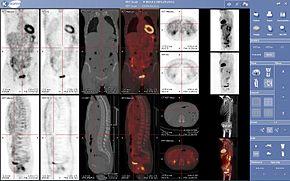Viewer medecine nucleaire keosys.JPG