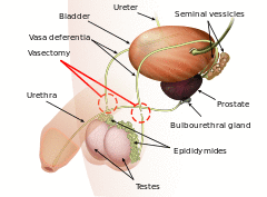 Vasectomy diagram-en.svg
