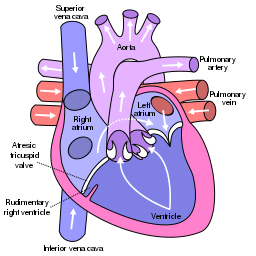 Tricuspid atresia.svg