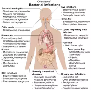 chart showing bacterial infections upon various parts of human body