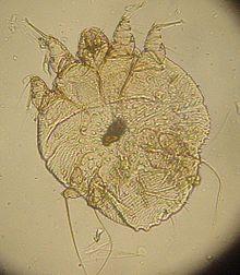 Sarcoptes scabei 2.jpg