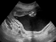Ultrasound Scan ND 152505 1531230 cr.png