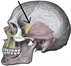 Gray188-Sphenoparietal suture.png