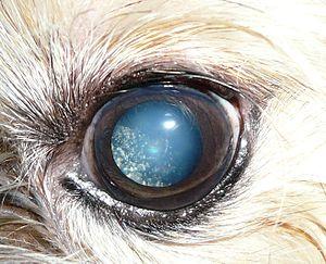 Asteroid hyalosis 3.JPG