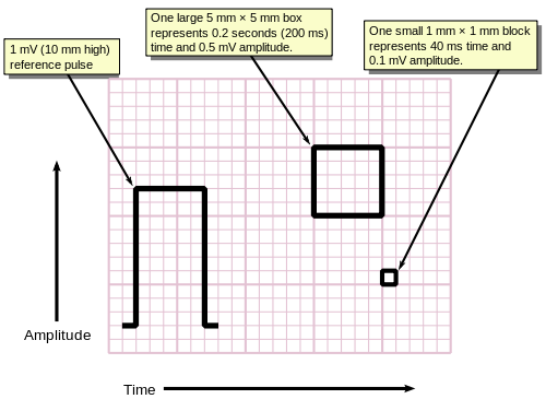 Measuring time and voltage with ECG graph paper