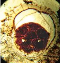 Doushantou Embryo Yinetal2007.jpg