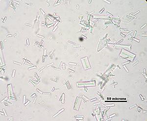 Struvite crystals dog with scale 1.JPG