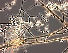 Acrophialophora fusispora microscopic.jpg