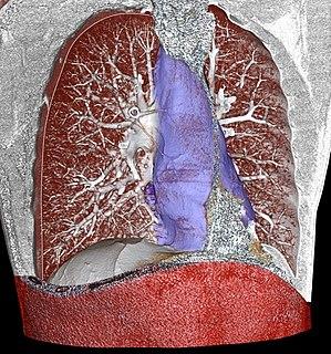 Mediastinum.jpg