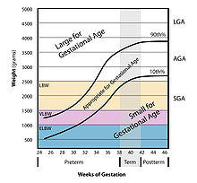 Weight vs gestational Age.jpg