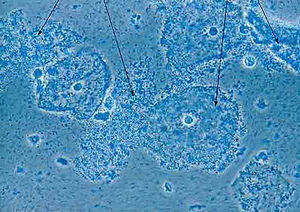 Vaginose-G15.jpg
