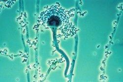 Aspergillus.gif