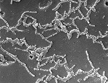 Mycobacterium chelonae PHIL227.tif