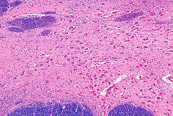 Nucleus basalis of Meynert - intermed mag.jpg