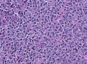 PRL HE histology.jpg