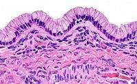 Histopathology of lining of a benign mucinous tumor of the ovary.jpg