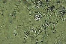 Mucor circinelloides1.jpg