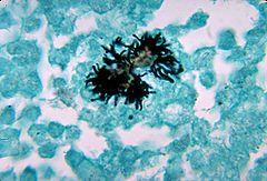 Actinomyces naeslundii 01.jpg