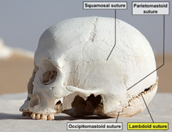WhiteDesertSkullCropped - Lambdoid suture.png
