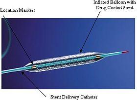 Taxus stent FDA.jpg