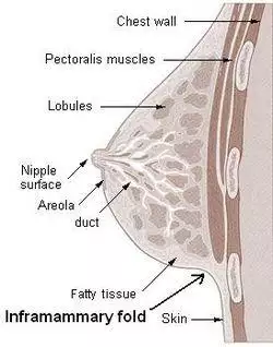Imframammary fold.jpg