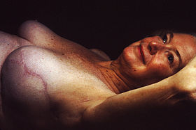 Breast reconstruction 2.jpg