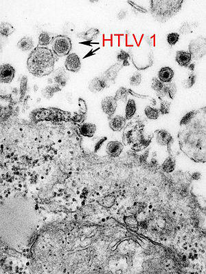 HTLV-1 EM 8241 lores.jpg